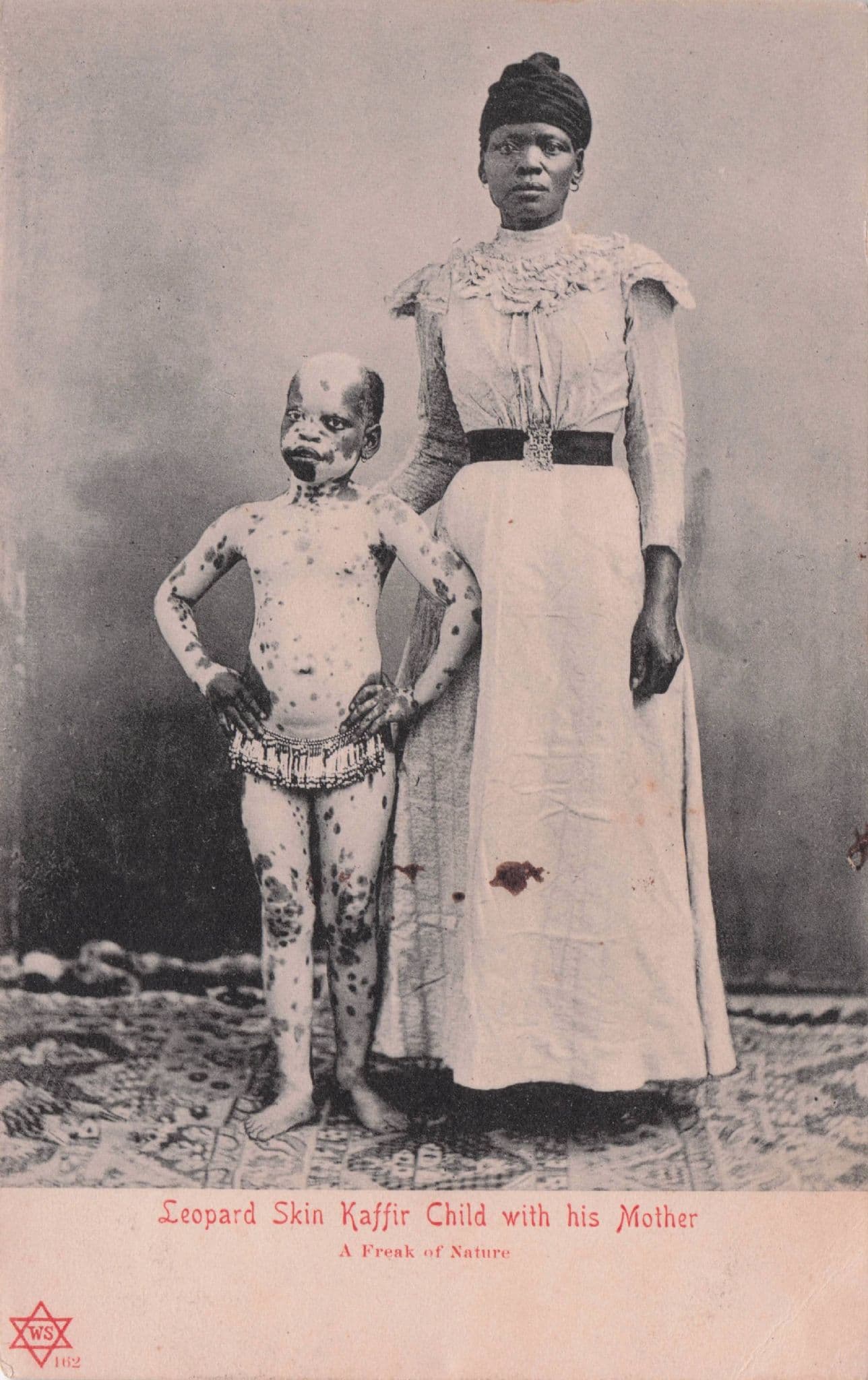 Leopard Skin Kaffir African Child Man Circus Human Freak Old Postcard