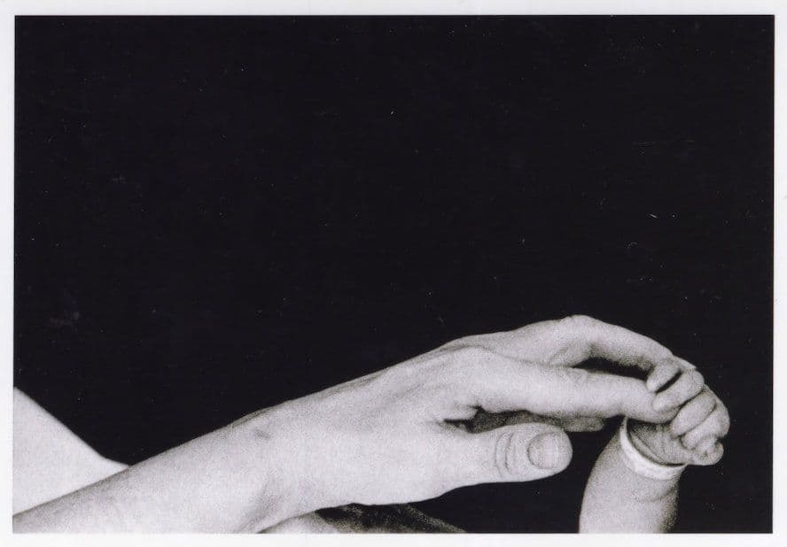 Long Island NY Mother & Child Freak Stretched Hand 1959 Award Photo Postcard