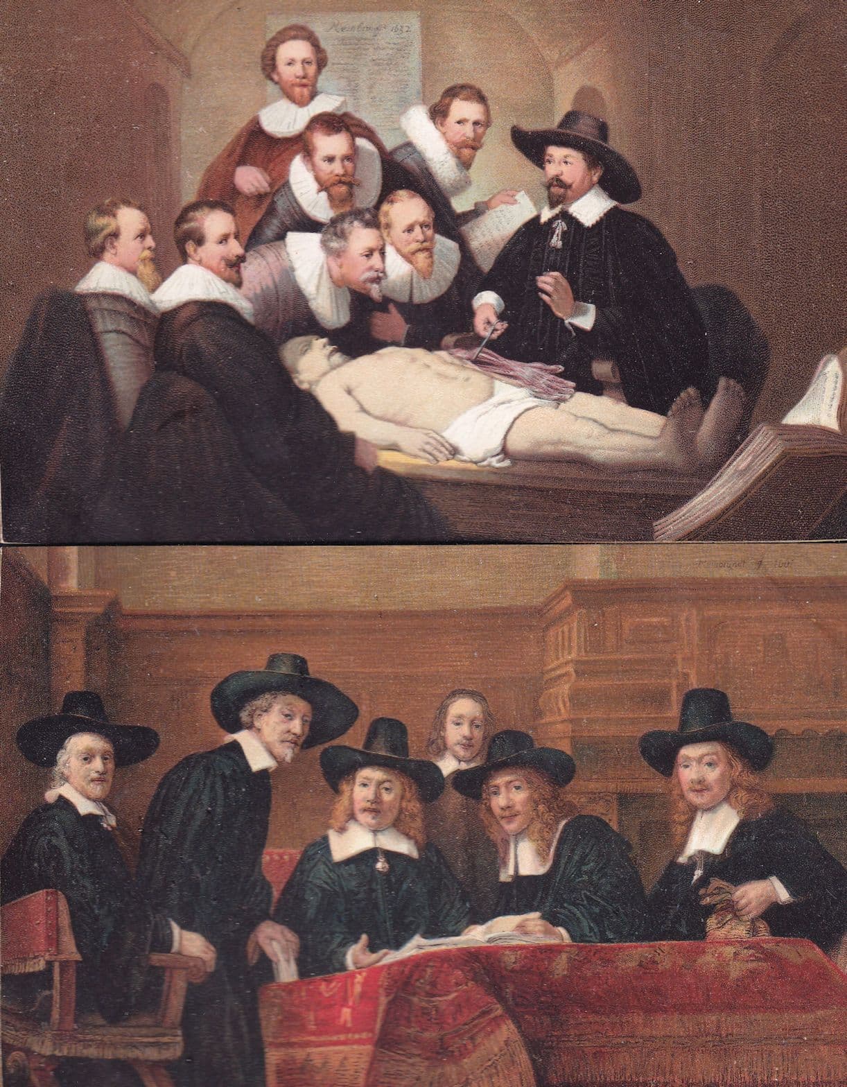 Man Doctor Operation On Intestines Rembrandt 2x Painting Postcard