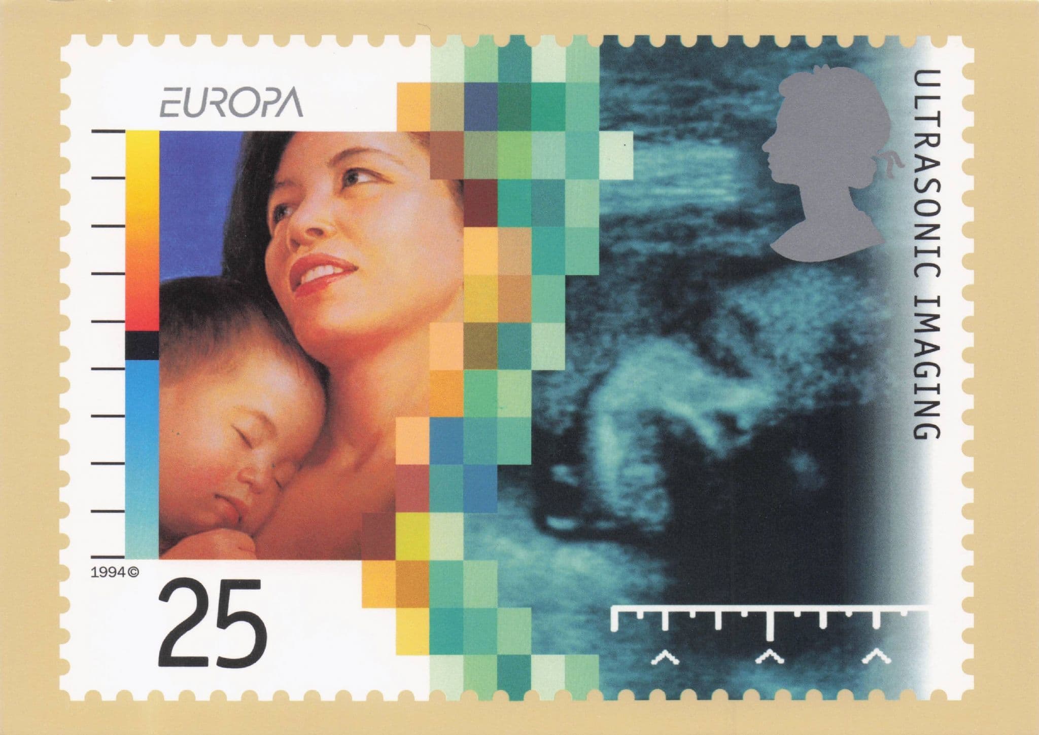 Ultrasound Medical Hospital Pregnancy Scanning Machine Postcard