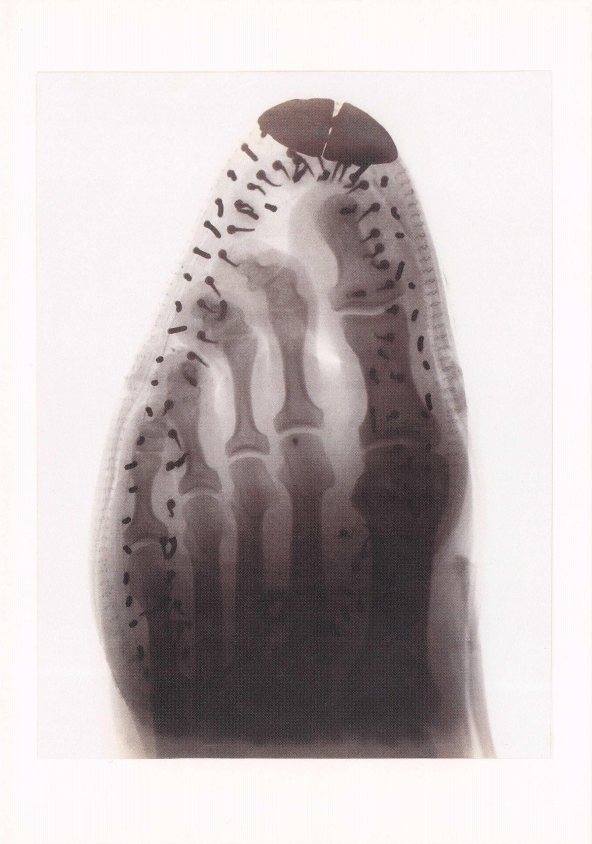 Victorian Foot In A Shoe 1896 Skeleton X-Ray Photo Award Art V&A Rare Postcard