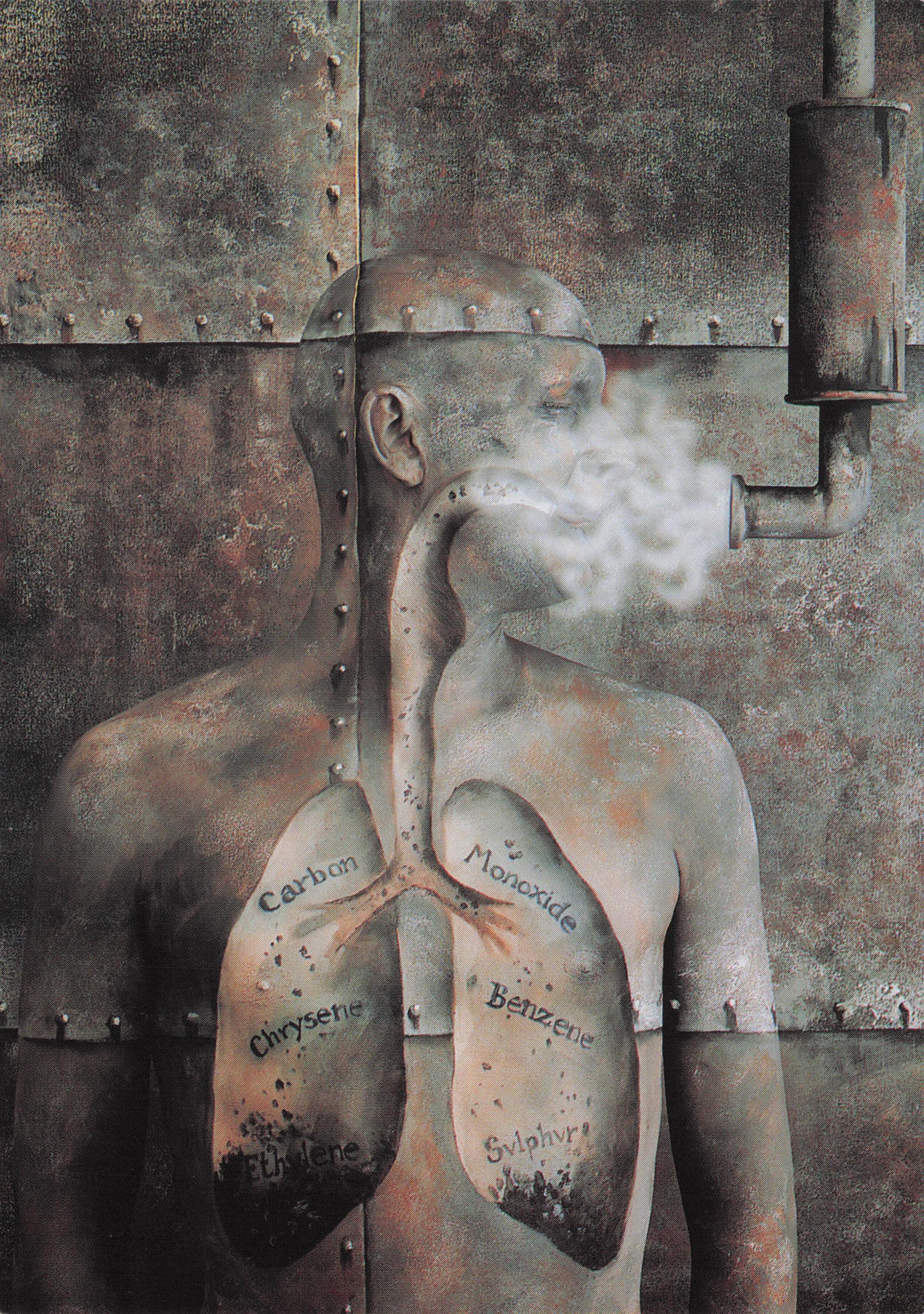 Anti Smoking Lung Damage Biology London Painting Postcard
