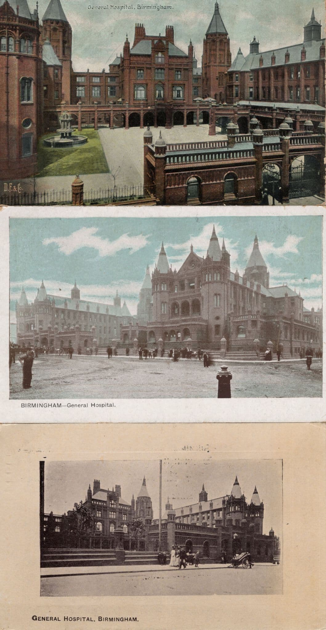 Birmingham Hospital  3x Antique Postcard s