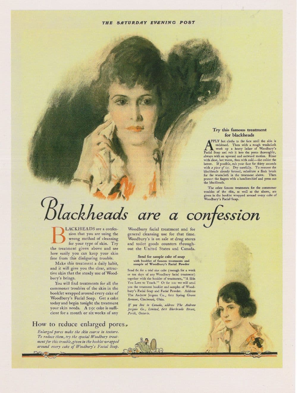 Blackheads Treatment Beauty Cake Cure Remedy Advertising Postcard