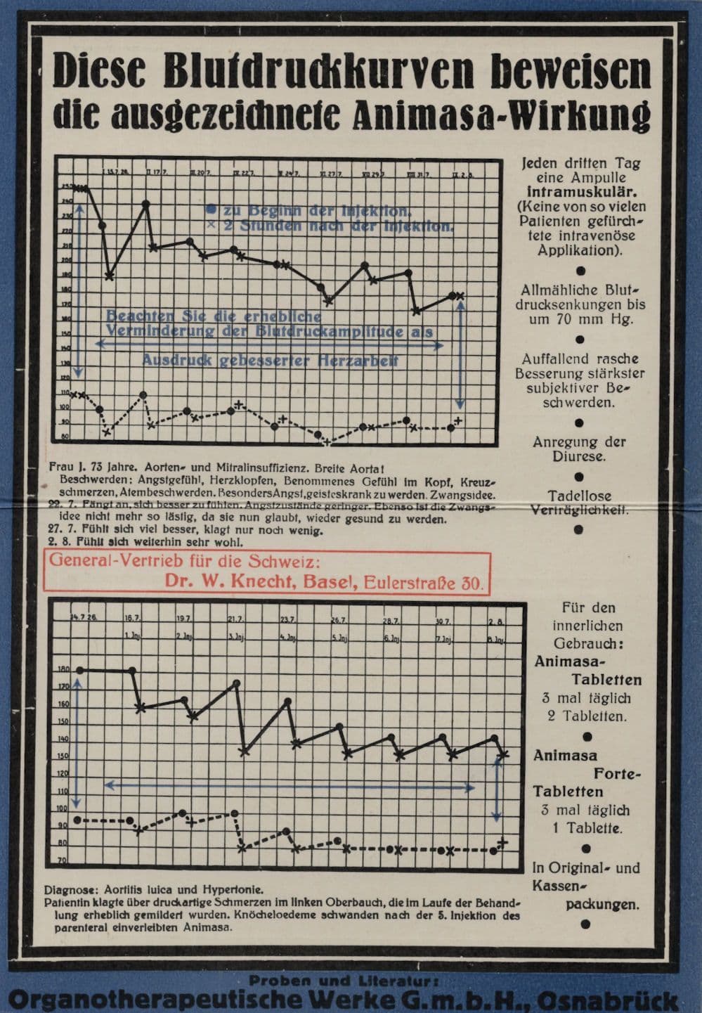 German Biotechnology Blood Pressure Medical Graph Antique Card