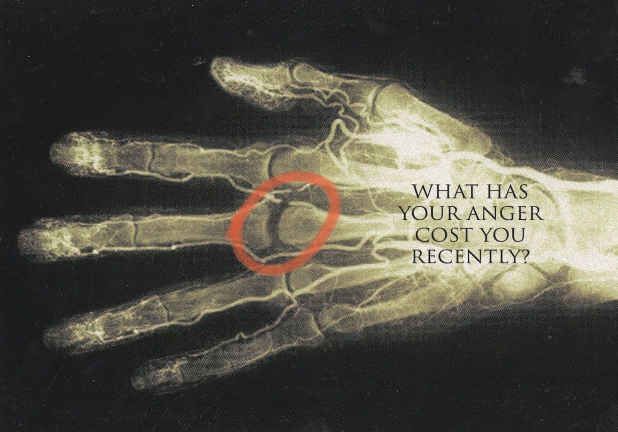 Hand Skeleton Anger Management Advertising Postcard