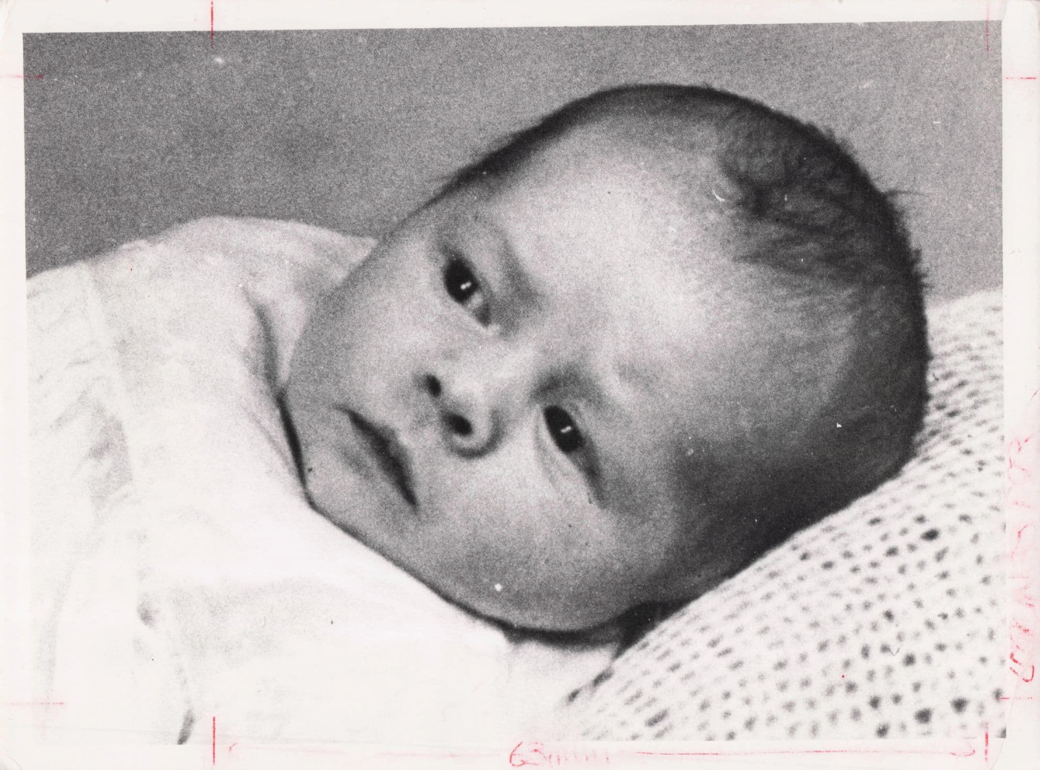 Lulu New Born Baby in Hospital Intensive Care 1977 London Press Photo